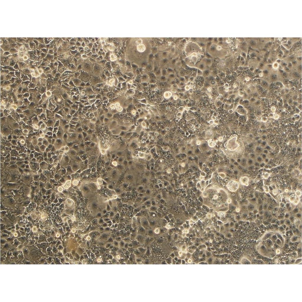 N-87 Cells#人胃癌细胞系复苏中心|完全培养基|STR图谱,N-87 Cells#