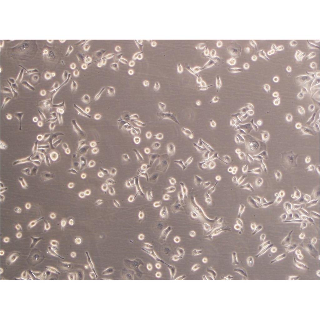 BT.549 Cells#人乳腺导管癌细胞系复苏中心|完全培养基|STR图谱,BT.549 Cells#