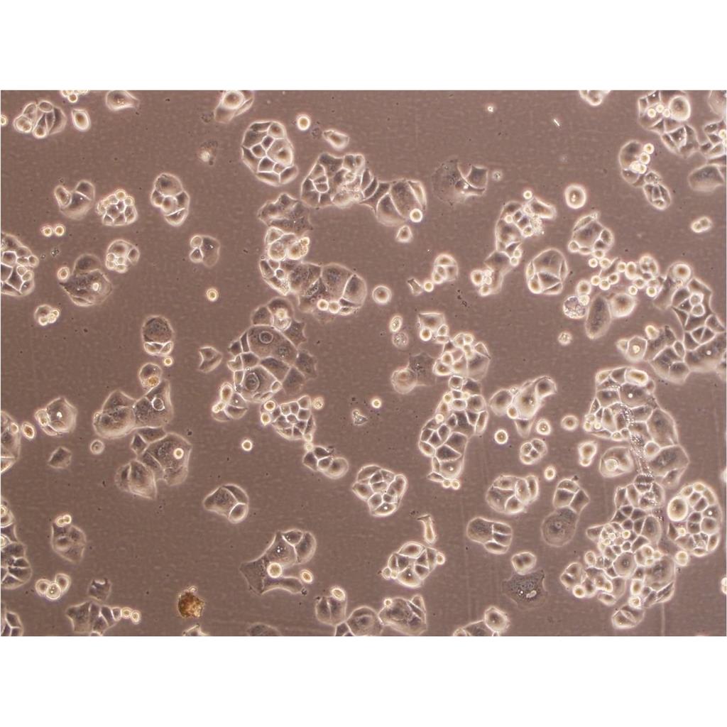 BHT-101 Cells#人甲状腺癌细胞系复苏中心|完全培养基|STR图谱,BHT-101 Cells#
