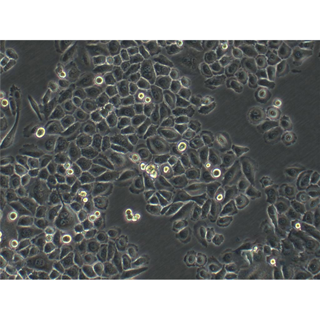 HCT-116 Cells#人結(jié)腸癌細(xì)胞系復(fù)蘇中心|完全培養(yǎng)基|STR圖譜,HCT-116 Cells#