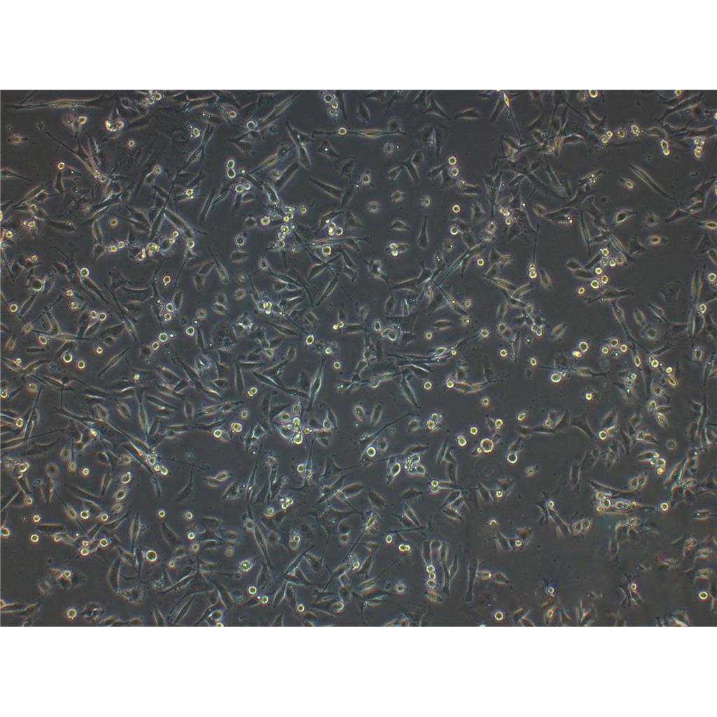 T-47-D Cells#人乳腺管癌细胞系复苏中心|完全培养基|STR图谱,T-47-D Cells#