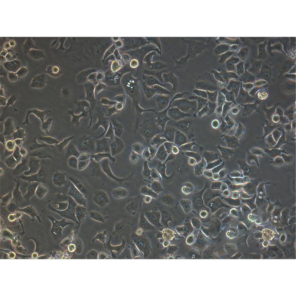 J82人膀胱移行癌細(xì)胞實驗室|已有STR圖譜,J82 CELLS