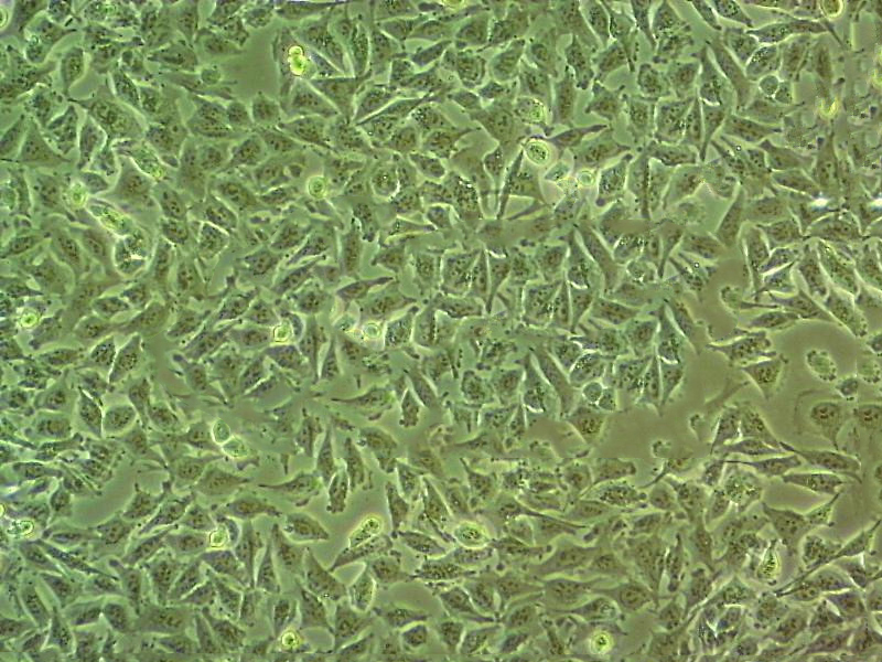 B95.8 Cells絨猴EBV轉(zhuǎn)化的白細(xì)胞系(提供STR圖譜),B95.8 Cells