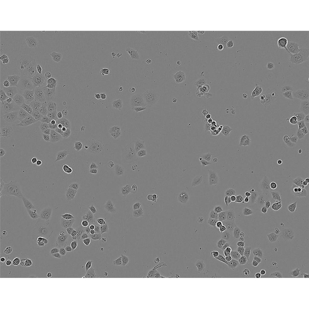 UACC 812 Cells人乳腺導(dǎo)管瘤細(xì)胞系(提供STR圖譜),UACC 812 Cells