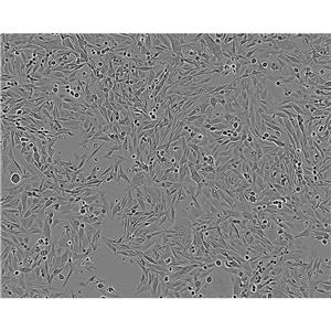 SK-Mel 1 Cells#人皮膚黑色素瘤細(xì)胞系復(fù)蘇中心|完全培養(yǎng)基|STR圖譜