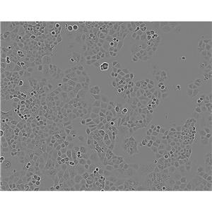 NCIH209 Cells#人小細(xì)胞肺癌細(xì)胞系復(fù)蘇中心|完全培養(yǎng)基|STR圖譜