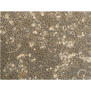 N-87 Cells#人胃癌细胞系复苏中心|完全培养基|STR图谱,N-87 Cells#