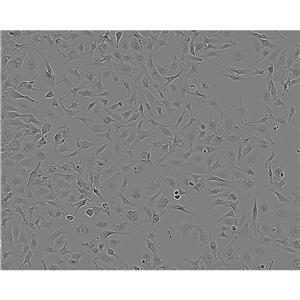 NCI-SNU-387 Cells#人肝癌細(xì)胞系復(fù)蘇中心|完全培養(yǎng)基|STR圖譜