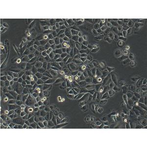SKMES-1 Cells#人肺鱗癌細(xì)胞系復(fù)蘇中心|完全培養(yǎng)基|STR圖譜