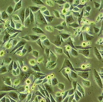 Circinella Lacrymispora,Circinella Lacrymispora