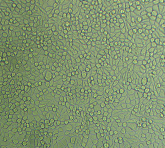 CL-11人結(jié)腸癌細(xì)胞新批次|培養(yǎng)基|送STR圖譜,CL-11 cells