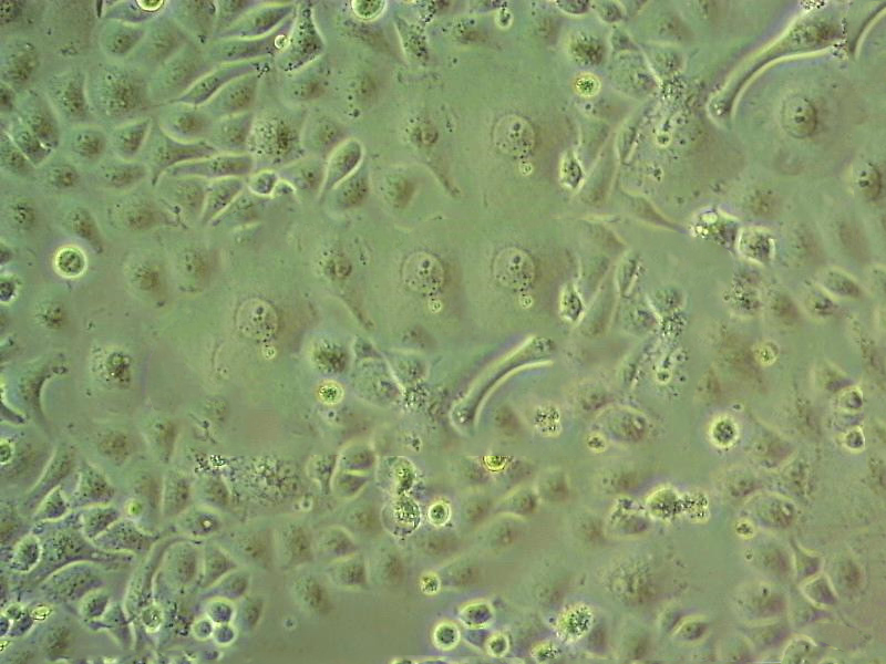 SW13 Cells#人腎上腺皮質(zhì)瘤細(xì)胞系復(fù)蘇中心|完全培養(yǎng)基|STR圖譜,SW13 Cells#