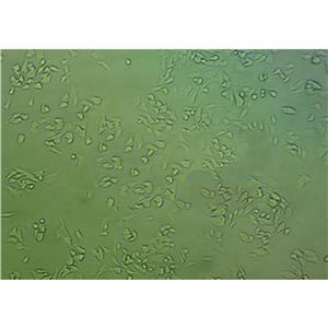 HPAF II Cells#人胰腺癌細(xì)胞系復(fù)蘇中心|完全培養(yǎng)基|STR圖譜,HPAF II Cells#