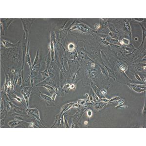 ATDC-5 Cells小鼠成軟骨細(xì)胞系(提供STR圖譜),ATDC-5 Cells