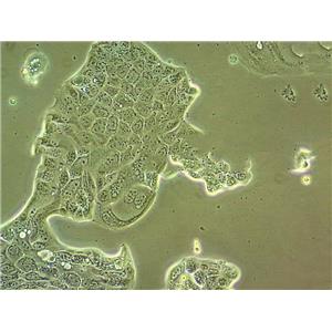 C1498 Cells小鼠白血病細(xì)胞系(提供STR圖譜),C1498 Cells