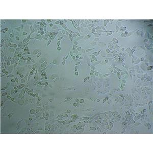 SK MES 1 Cells#人肺鱗癌細(xì)胞系復(fù)蘇中心|完全培養(yǎng)基|STR圖譜