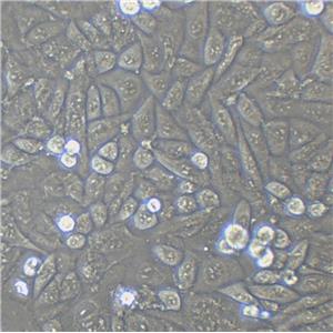 PLA801D Cells#人高轉(zhuǎn)移肺癌細(xì)胞系復(fù)蘇中心|完全培養(yǎng)基|STR圖譜