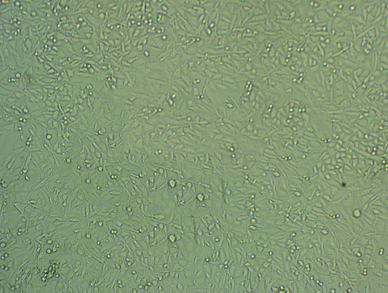 MB468 Cells#人乳腺癌細(xì)胞系源頭種子庫|培養(yǎng)基|STR圖譜,MB468 Cells#