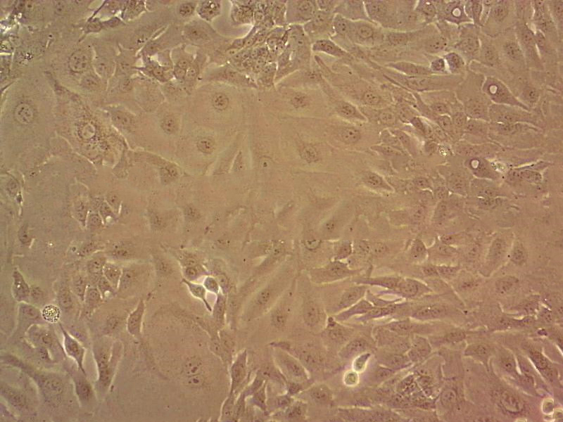 HSC-2人口腔鱗狀腫瘤細(xì)胞代次低|培養(yǎng)基|送STR圖譜,HSC-2 cells