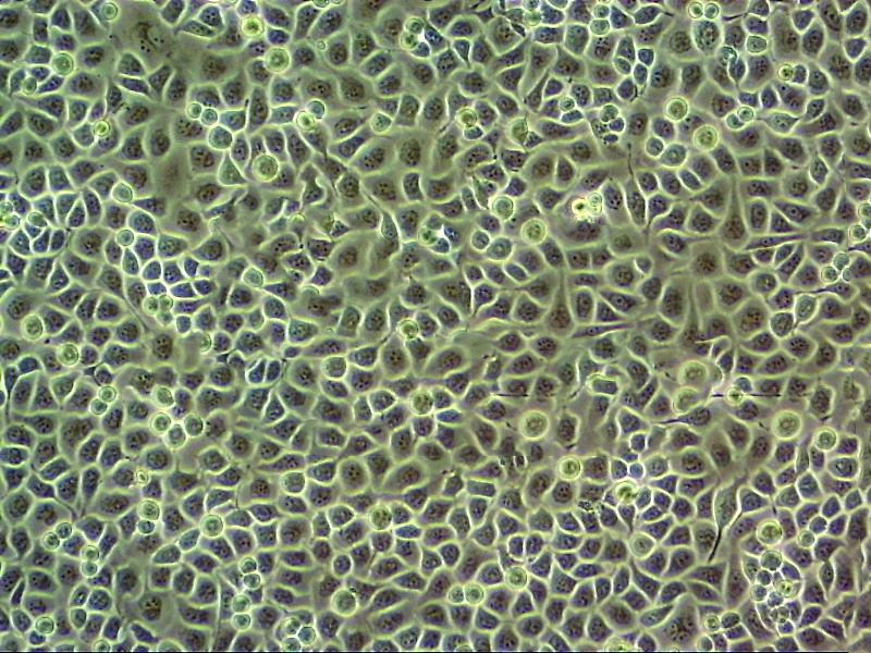 PLC-8024 Cells#人肝癌亞力山大細(xì)胞系源頭種子庫|培養(yǎng)基|STR圖譜,PLC-8024 Cells#