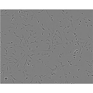 HCT 8 Cells#人结直肠腺癌细胞系复苏中心|完全培养基|STR图谱