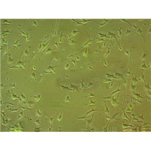 SKHEP-1 Cells#人肝癌细胞系源头种子库|培养基|STR图谱,SKHEP-1 Cells#