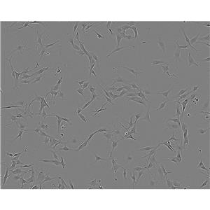 U251MG Cells#人神經(jīng)膠質(zhì)瘤細(xì)胞系源頭種子庫(kù)|培養(yǎng)基|STR圖譜