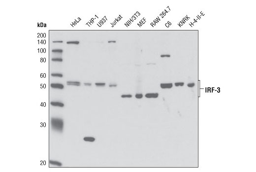 人源反應(yīng)性STING信號通路抗體組合試劑盒,Human-Reactive STING Pathway Antibody Sampler Kit