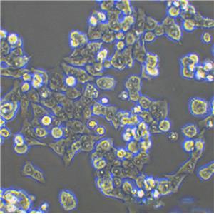 HuT78 Cells#人T淋巴瘤細胞系源頭種子庫|培養(yǎng)基|STR圖譜