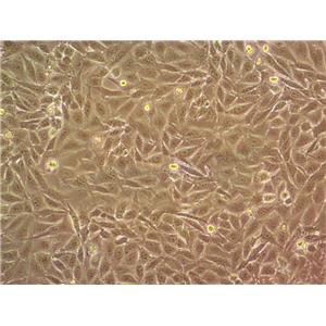 KATOIII Cells#人胃癌细胞系源头种子库|培养基|STR图谱,KATOIII Cells#