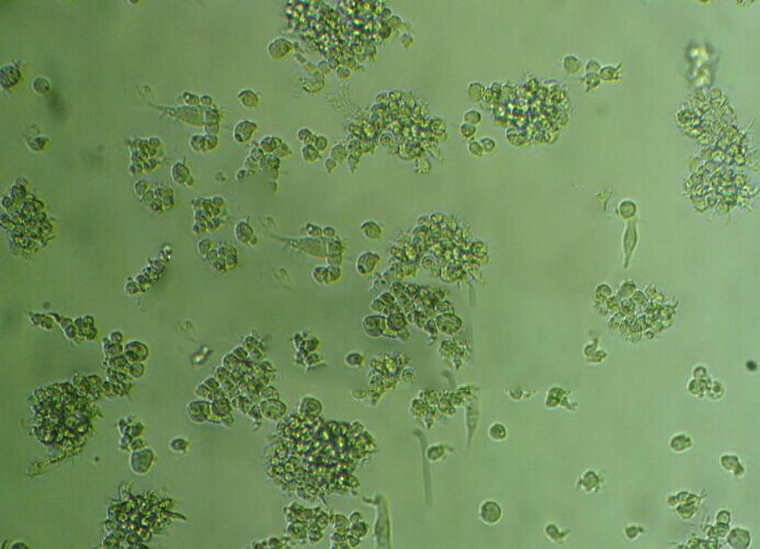 CA46 Cells人Burkitt's淋巴瘤可傳代細(xì)胞系(送STR鑒定圖譜),CA46 Cells