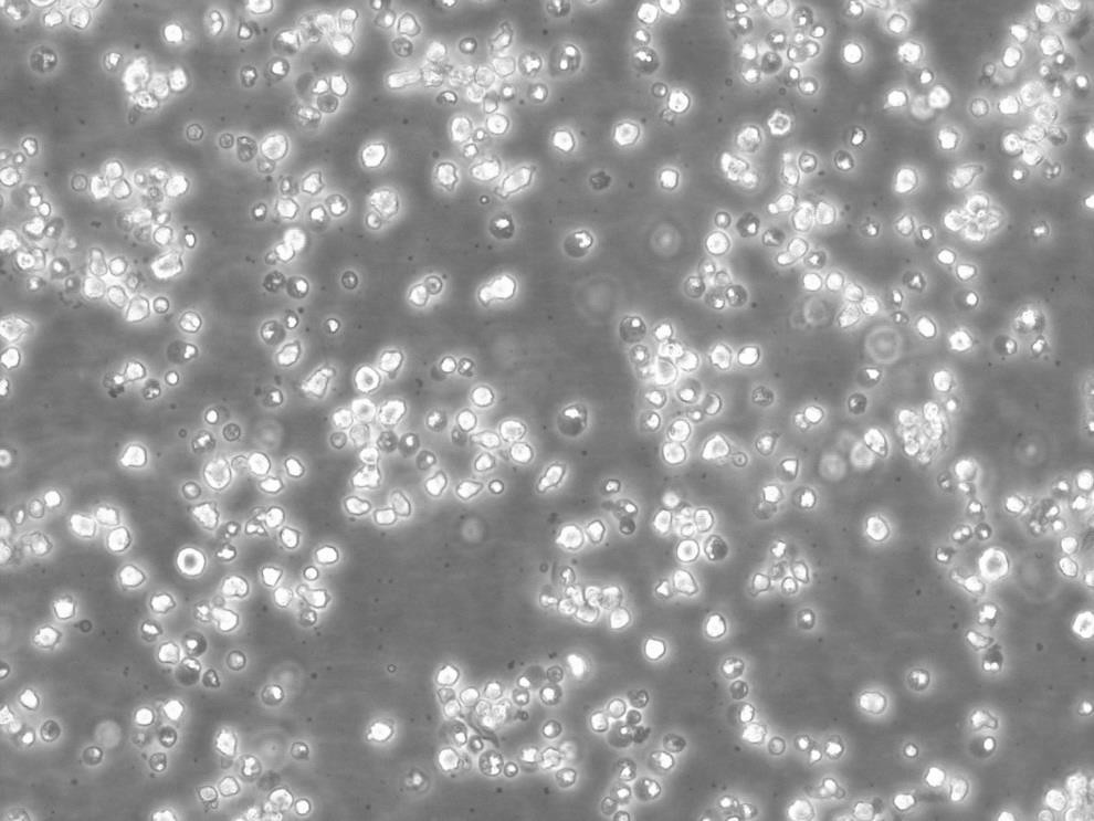 HT(H9) Cells人T淋巴瘤懸浮細胞系(提供全部細胞STR鑒定圖譜),HT(H9) Cells