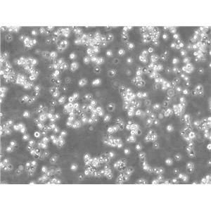 WSU-DLCL2 Cells人彌漫大B淋巴瘤懸浮細胞系(提供全部細胞STR鑒定圖譜)