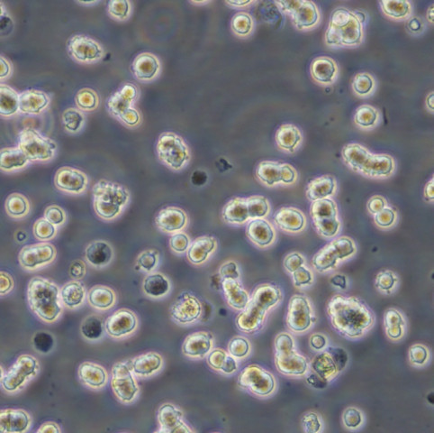 MC/CAR Cells人外周血淋巴懸浮細胞系(提供全部細胞STR鑒定圖譜),MC/CAR Cells