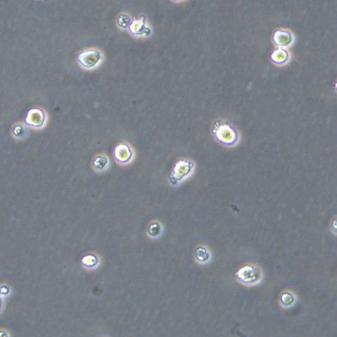 skm-1 Cells人急性髓系白血病懸浮細(xì)胞系(提供全部細(xì)胞STR鑒定圖譜),skm-1 Cells