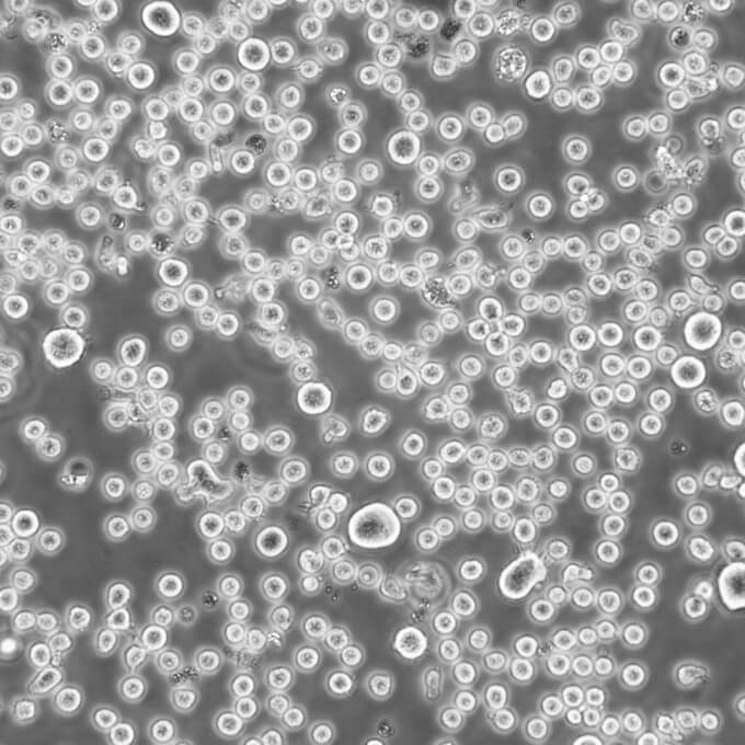 P3-NS1/1-Ag4-1 Cells小鼠骨髓瘤可傳代細(xì)胞系(送STR鑒定圖譜),P3-NS1/1-Ag4-1 Cells