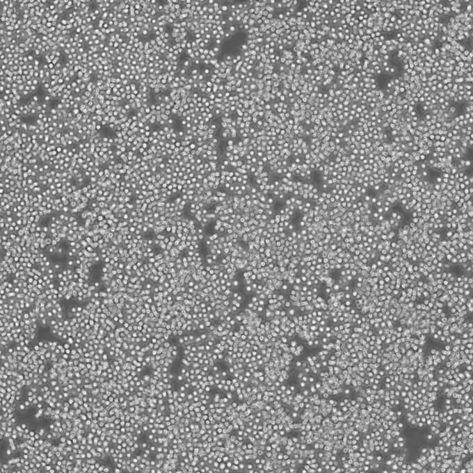 NK 10a Cells人Burkkit淋巴瘤可傳代細(xì)胞系(送STR鑒定圖譜),NK 10a Cells
