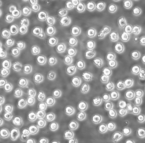 MKN 45 Cells人胃癌可傳代細(xì)胞系(送STR鑒定圖譜),MKN 45 Cells