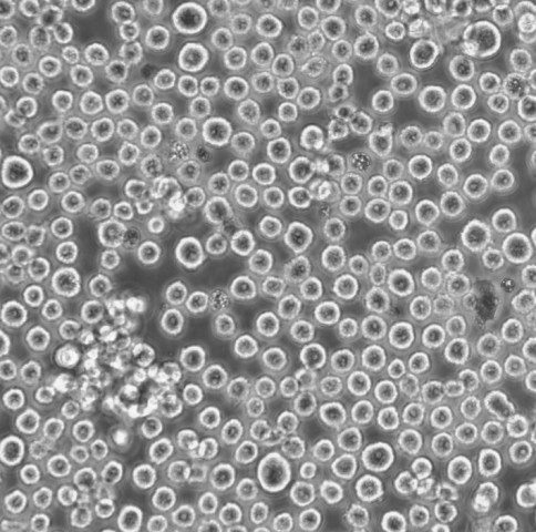 COLO_320DM Cells人結(jié)直腸腺癌可傳代細(xì)胞系(送STR鑒定圖譜),COLO_320DM Cells