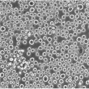 SUP-T1 Cells人T淋巴母細(xì)胞瘤懸浮細(xì)胞系(提供全部細(xì)胞STR鑒定圖譜)