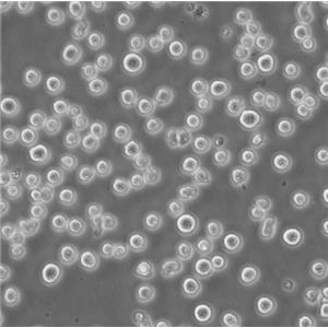 MEC-1 Cells人慢性B细胞白血病悬浮细胞系(提供全部细胞STR鉴定图谱)