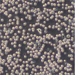 NK10a Cells人Burkkit淋巴瘤可傳代細胞系(送STR鑒定圖譜)