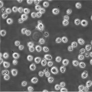 SUPB-15 Cells人Ph+急淋白血病可傳代細胞系(送STR鑒定圖譜)