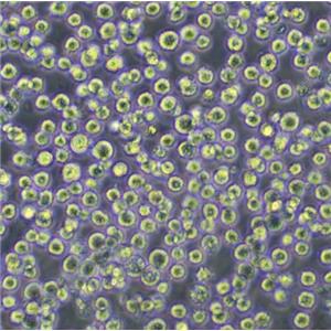 CA 46 Cells人burkitt淋巴瘤可傳代細(xì)胞系(送STR鑒定圖譜),CA 46 Cells