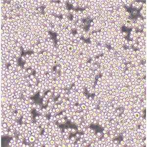 SUDHL4 Cells人彌漫性組織淋巴瘤可傳代細(xì)胞系(送STR鑒定圖譜),SUDHL4 Cells