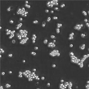 L5178Y TK+/-3.7.2c Cells小鼠淋巴瘤可傳代細(xì)胞系(送STR鑒定圖譜),L5178Y TK+/-3.7.2c Cells