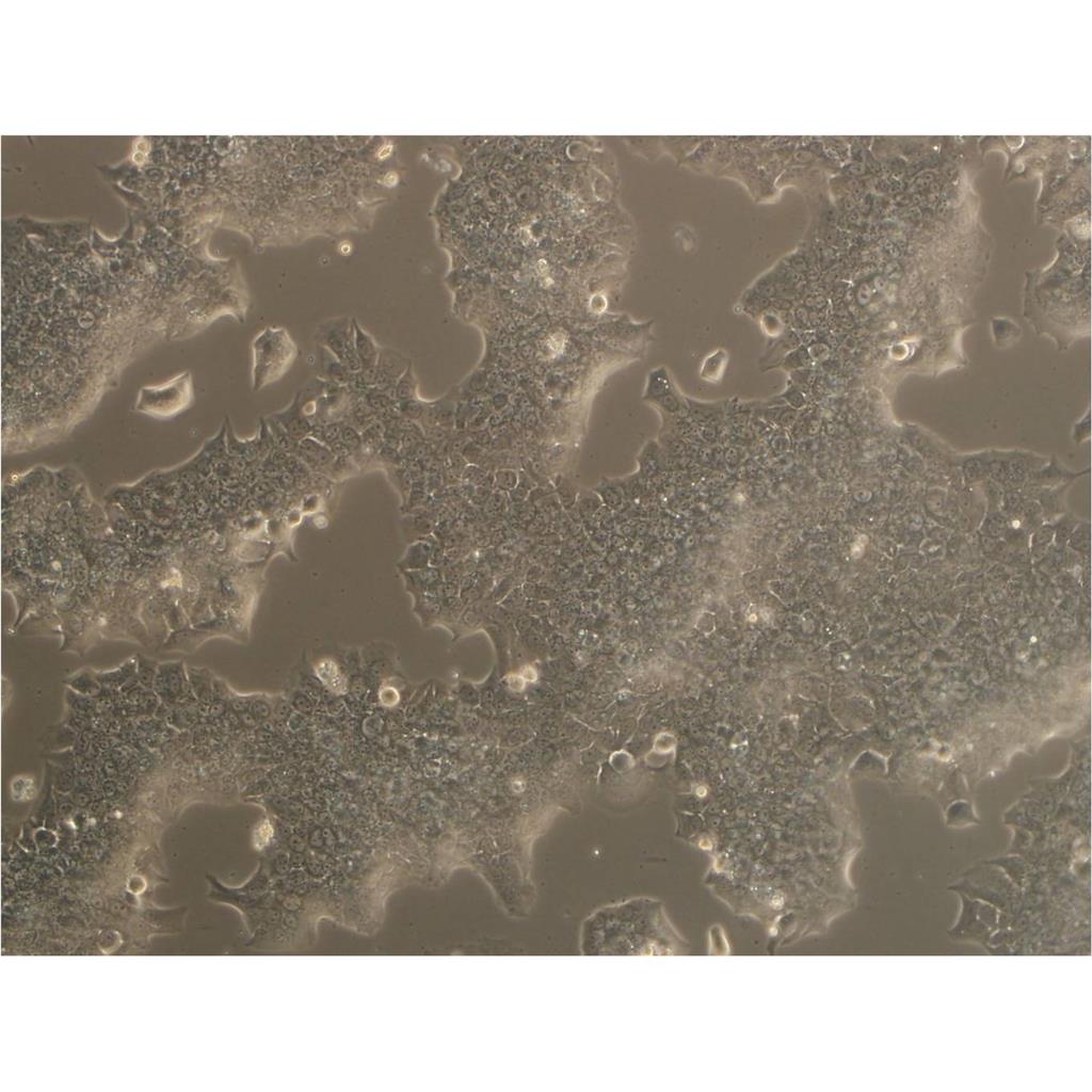 NCIH1703 Cells#人肺腺鱗癌細胞系源頭種子庫|培養(yǎng)基|STR圖譜,NCIH1703 Cells#