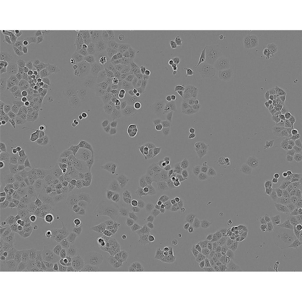 mda-415 Cells#人乳腺腺癌細胞系源頭種子庫|培養(yǎng)基|STR圖譜,mda-415 Cells#