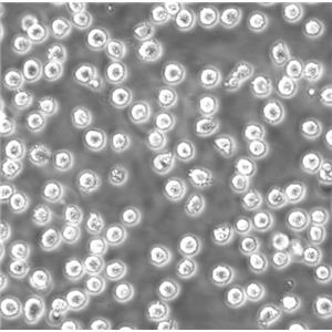 COLO-320-DM Cells人結直腸腺癌懸浮細胞系(提供全部細胞STR鑒定圖譜)