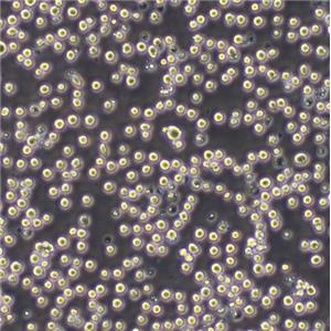 HCC38 BL Cells人淋巴母可傳代細胞系><EBV轉(zhuǎn)化>(送STR鑒定圖譜)